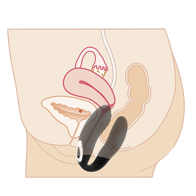 Remote Control Vagin Massage Vibrator Invisible Vibrator Klitoris