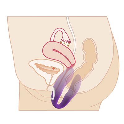 Remote Control Vagin Massage Vibrator Invisible Vibrator Klitoris